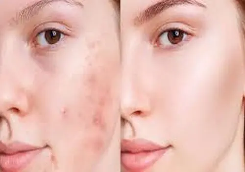  برای لاغرتر دیده شدن چه لباسی بپوشیم؟