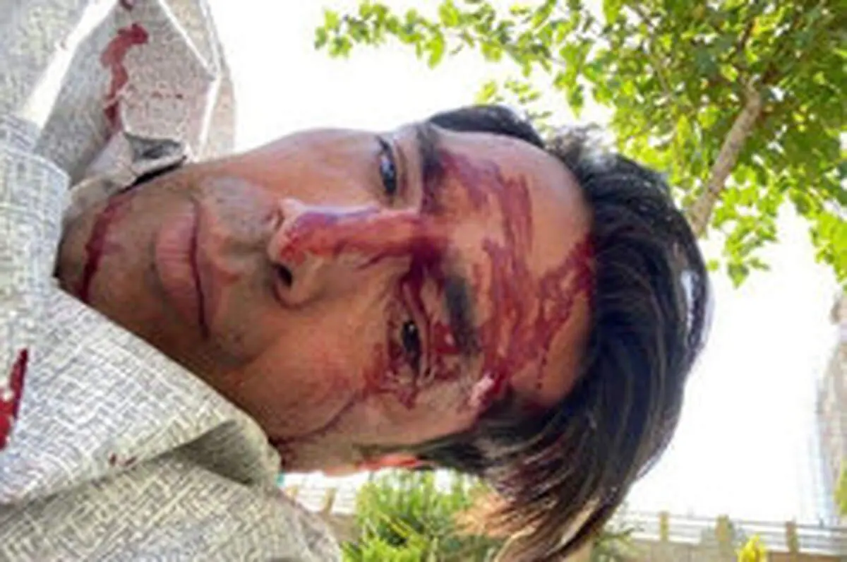تازه‌ترین عکس امیرحسین صادقی در بیمارستان