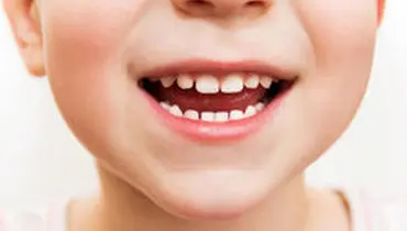 دندان عقل چه زمانی باید کشیده شود؟