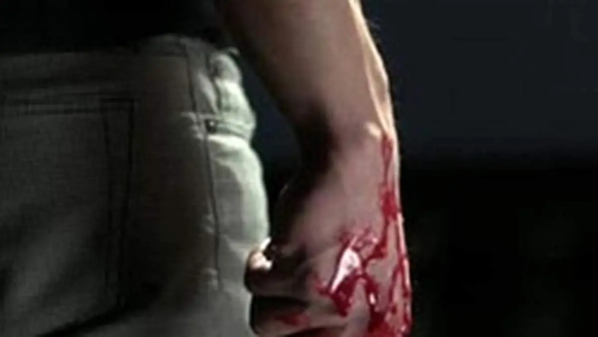 جوانی سر پسر همسایه را با کلنگ شکافت!