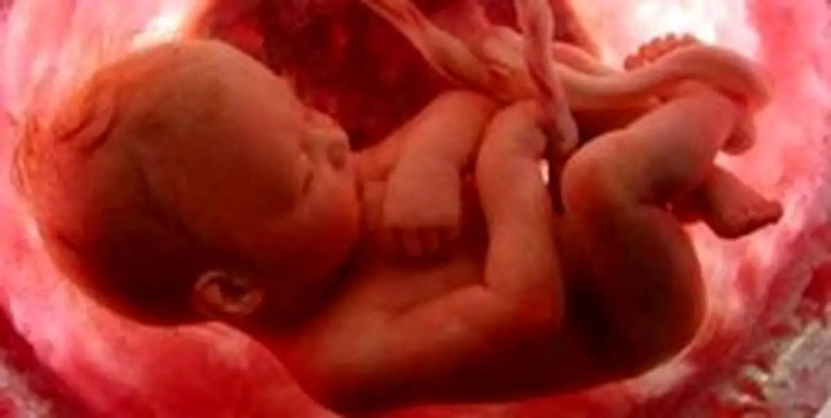 ماده‌ای که به مغز جنین آسیب می‌زند