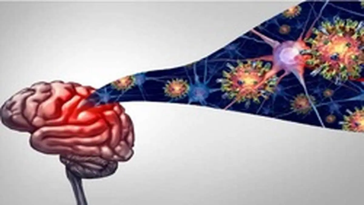 دردناک‌ترین علائم عصبی ابتلا به کرونا