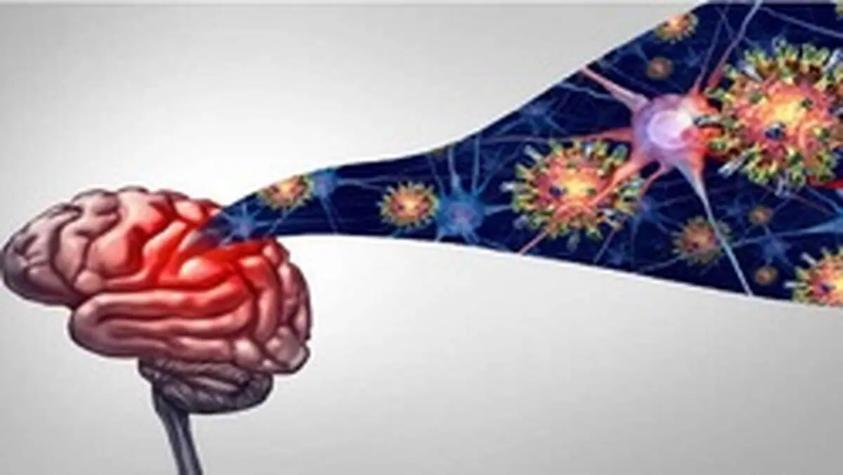 دردناک‌ترین علائم عصبی ابتلا به کرونا