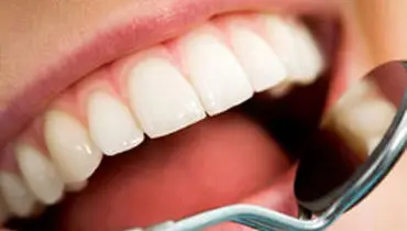 باورهای اشتباه درباره سلامت دهان و دندان