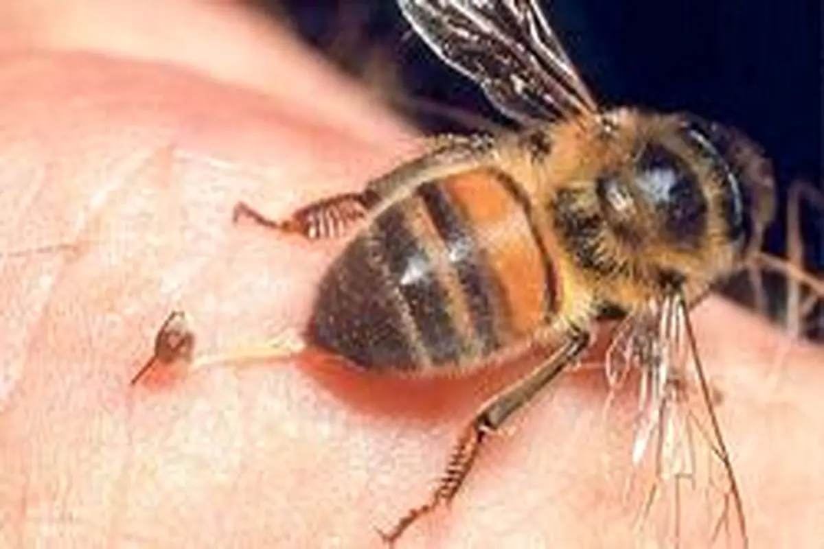 تاثیر باورنکردنی زهر زنبور عسل بر سرطان پستان