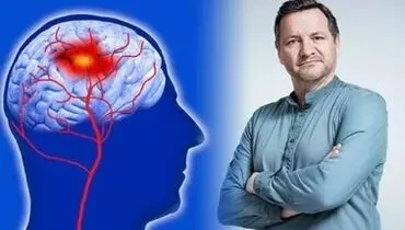 راهکارهای موثر برای جلوگیری از سکته مغزی