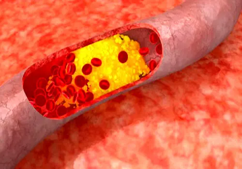 این ماست کلسترول شما را از بین می برد
