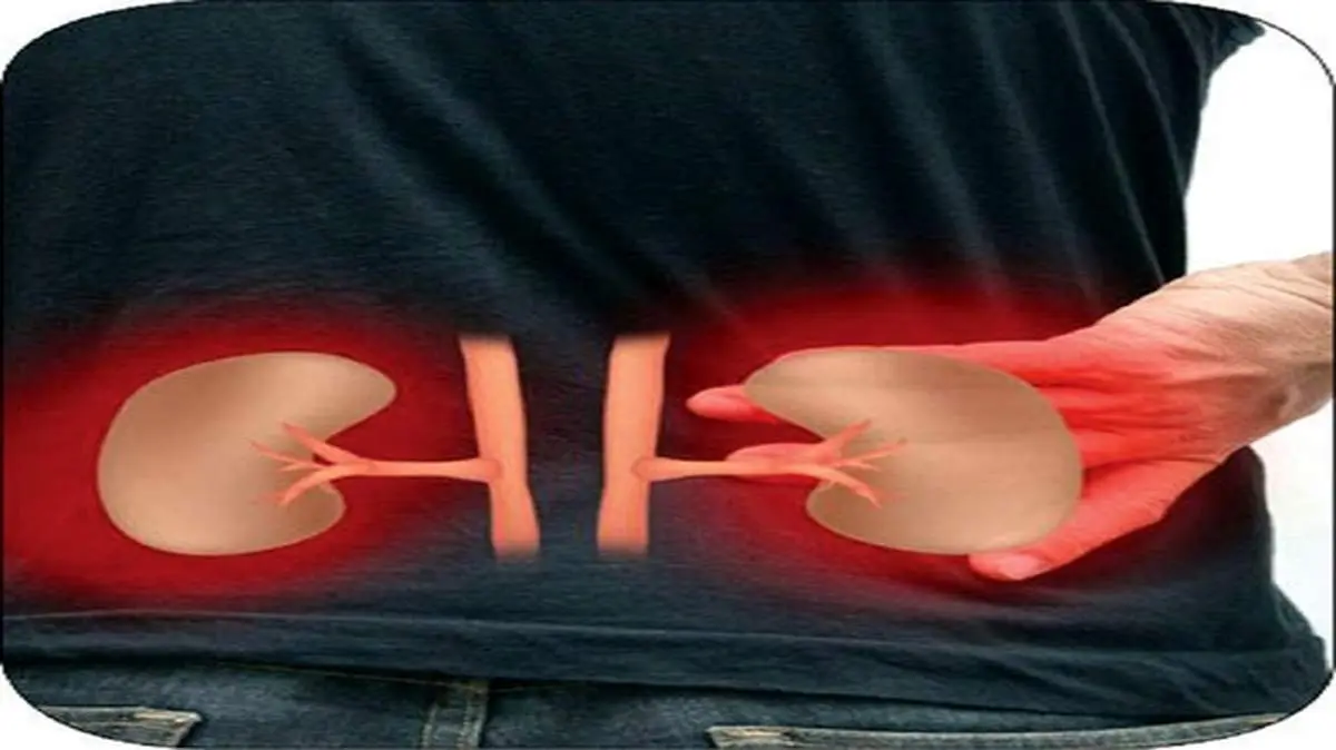 چگونه تفاوت کلیه درد با کمردرد را بفهمیم؟