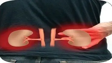 چگونه تفاوت کلیه ‌درد با کمردرد را بفهمیم؟