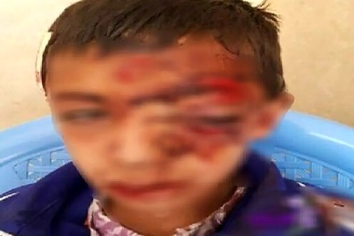 جزییات سقوط خونین دانش‌آموز قاینی از کوه بخاطر آنتن دهی موبایل + عکس