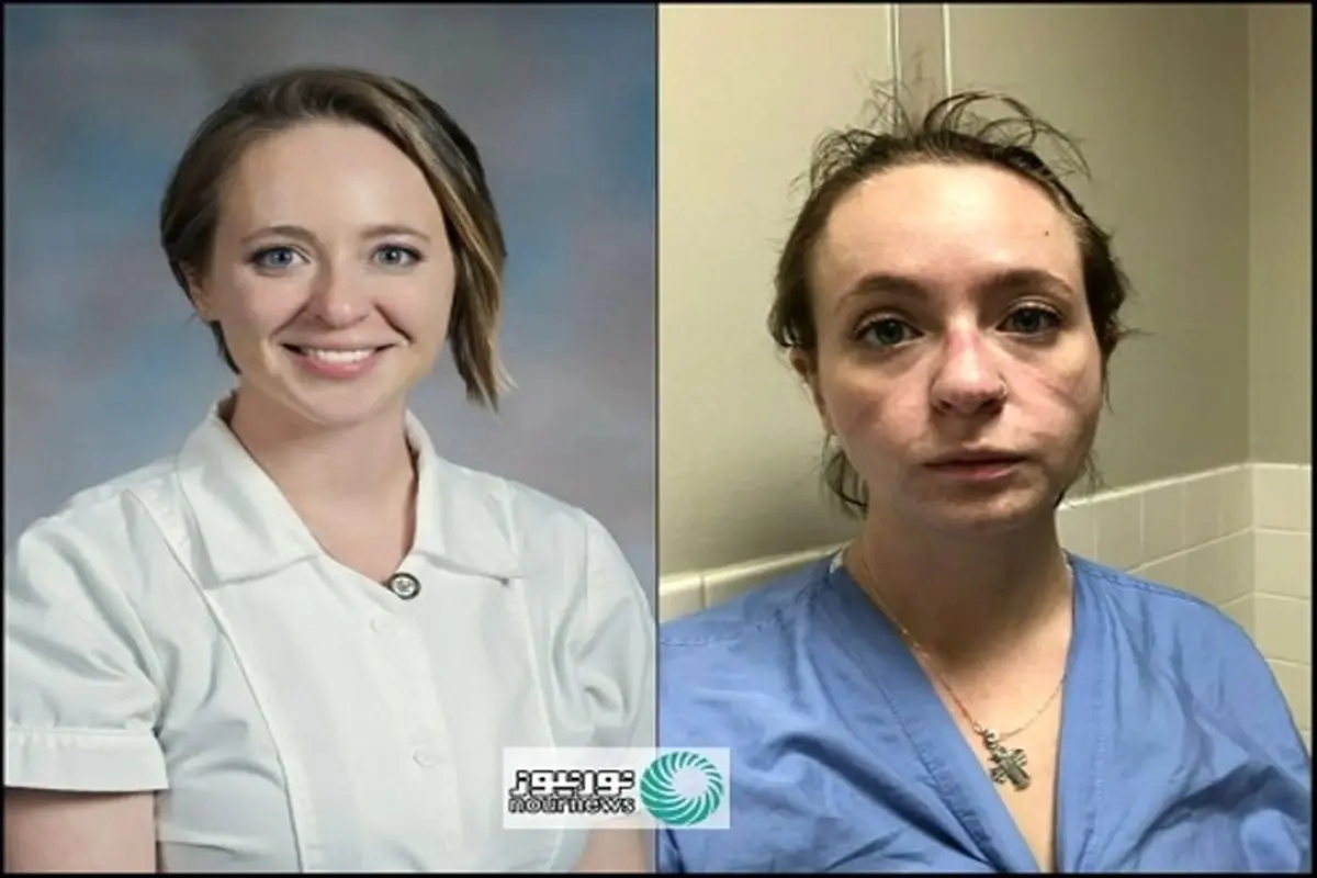 پرستار آمریکایی قبل و بعد از شیوع کرونا+عکس