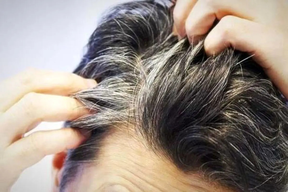 راهکارهایی برای جلوگیری از بروز مو‌های سفید