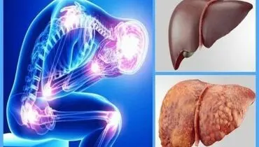 راهکارهای مقابله با کبد چرب