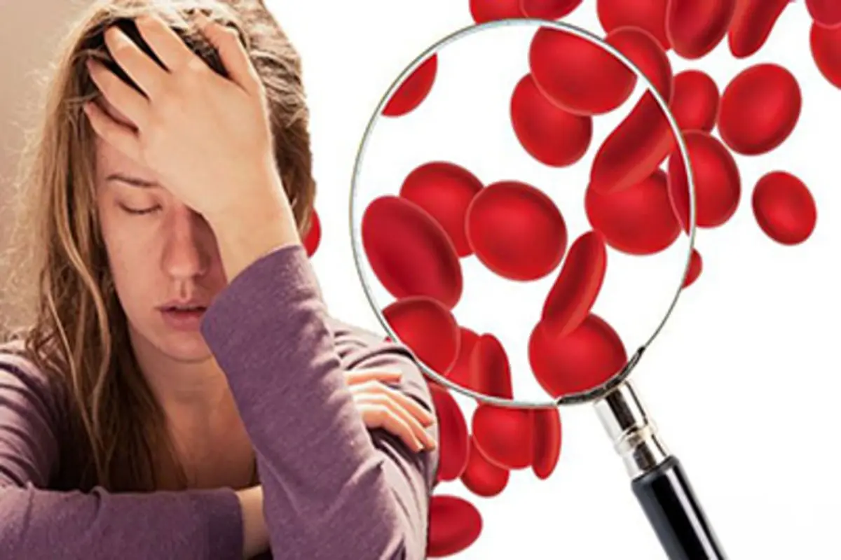 شایع ترین علائم کم خونی چیست؟ + روش درمان