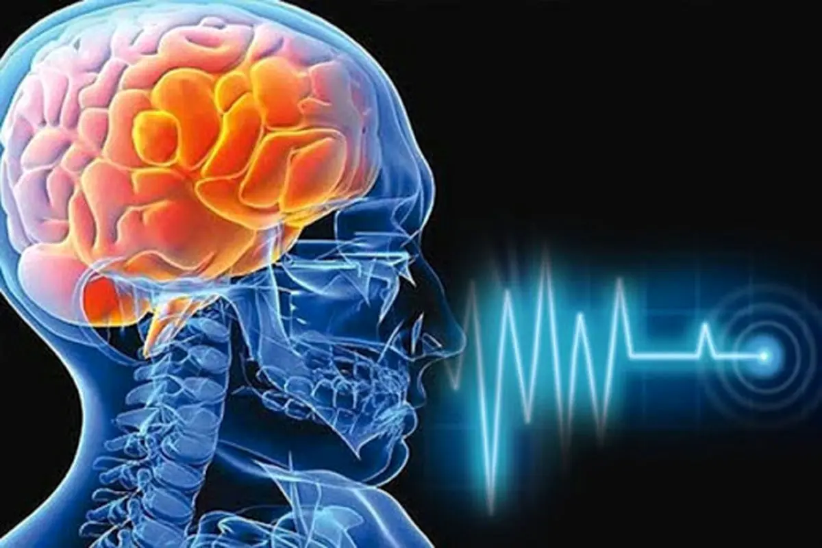 رایج‌ترین نشانه‌های وقوع سکته مغزی چیست؟
