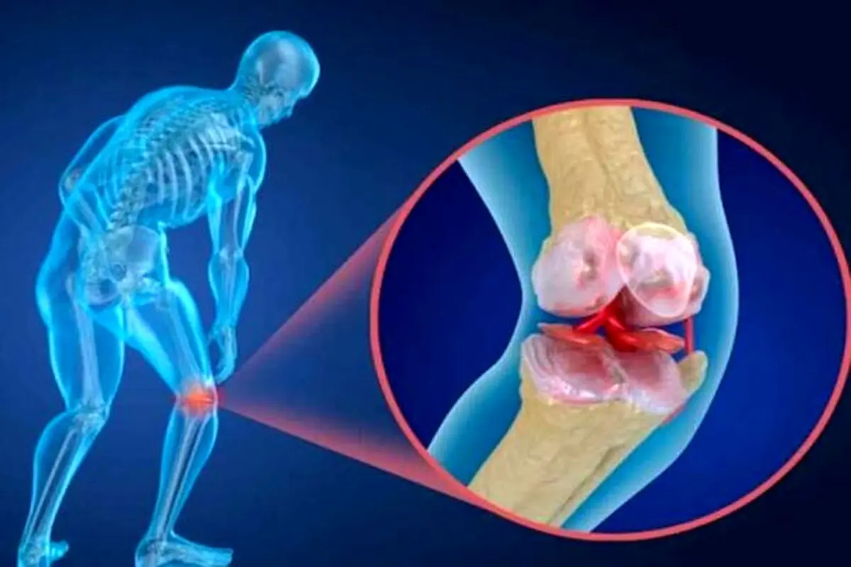 خوراکی های مفید برای پیشگیری از پوکی استخوان