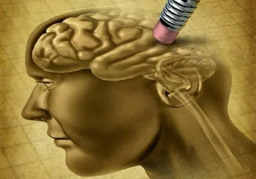 یک عامل خطر جدید برای زوال عقل شناسایی شد

