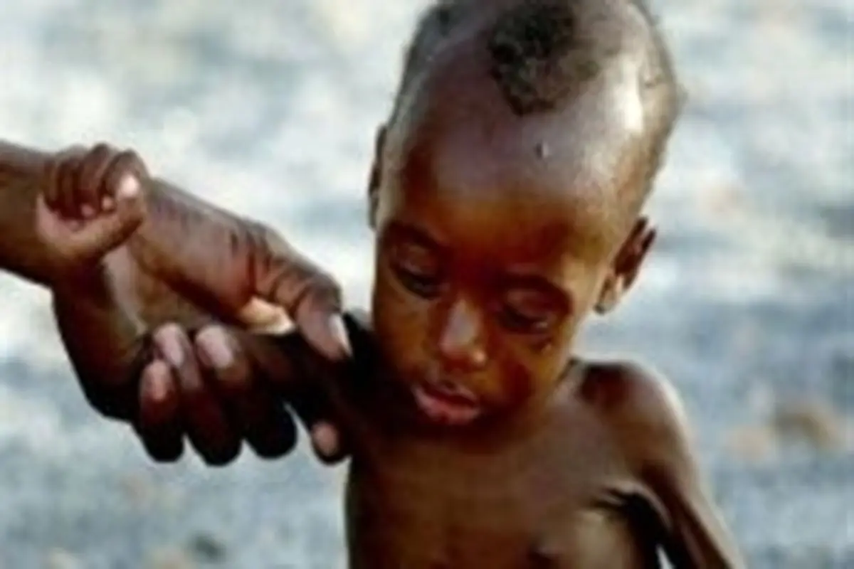نیم میلیون کودک آفریقایی در آستانه مرگ