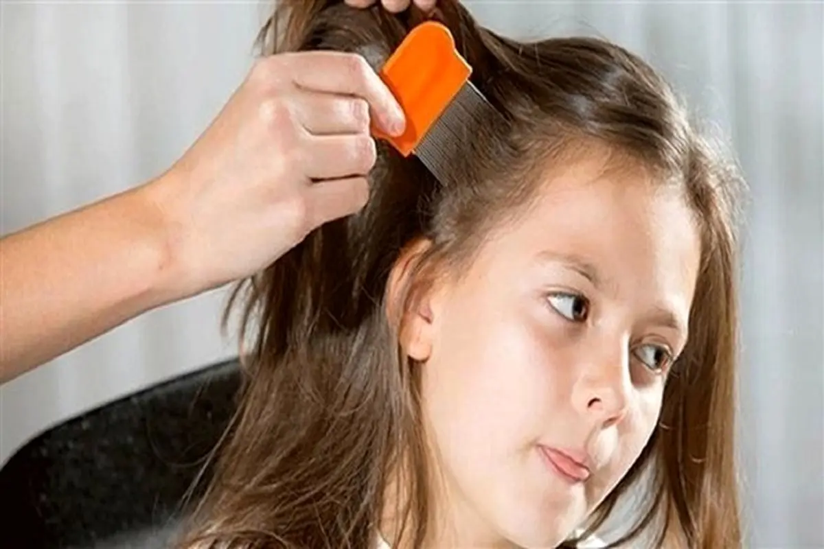 راه برای درمان شپش موی کودکان