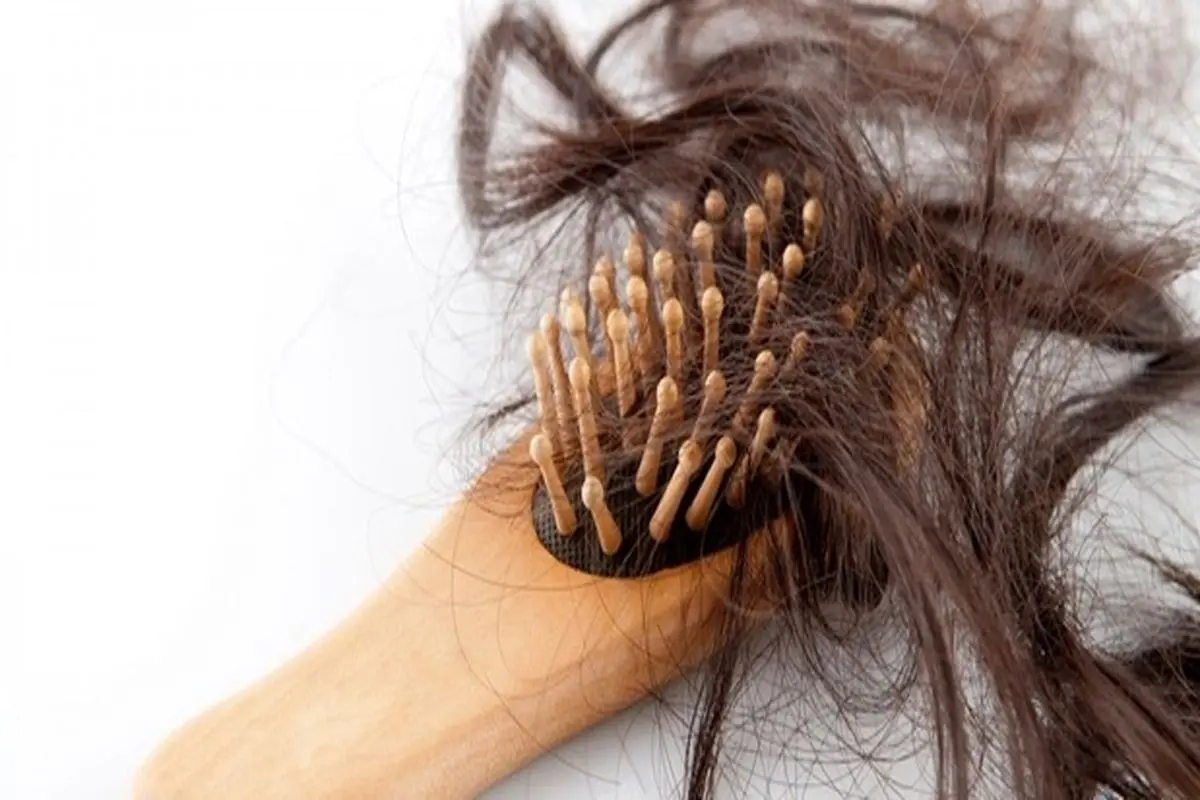 کاهش خطر ریزش موی سر با دو مکمل غذایی