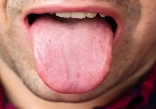 آنچه جرم گوش درباره سلامت بدن فاش می‌کند

