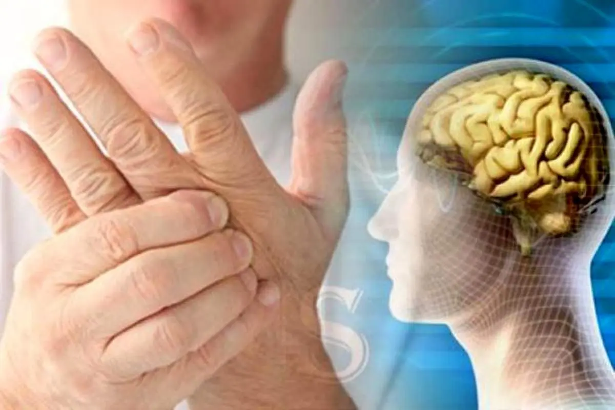 ۵ علائم زودهنگام ابتلا به بیماری ام اس