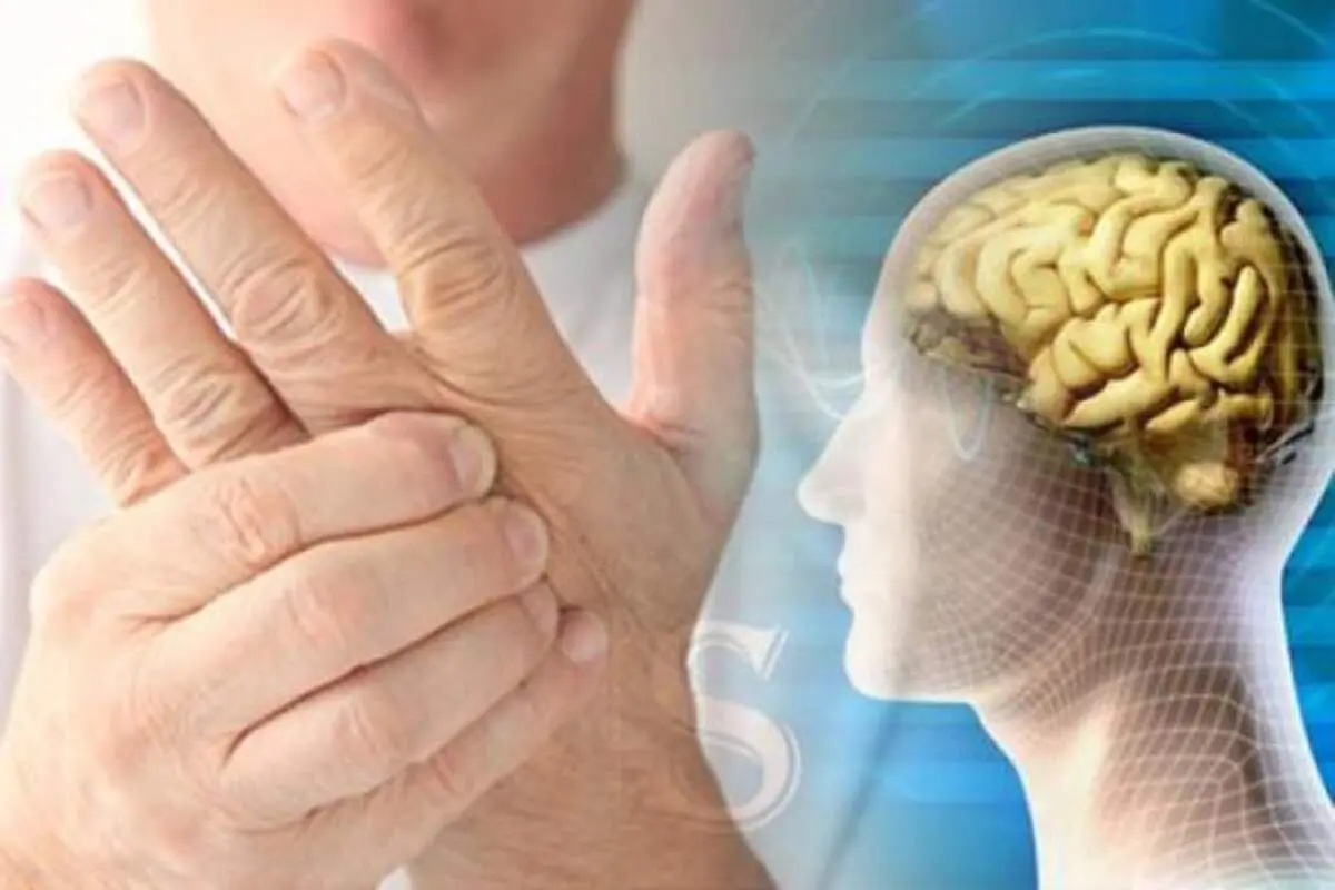 ۵ علائم زودهنگام ابتلا به بیماری ام اس