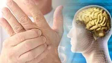 ۵ علائم زودهنگام ابتلا به بیماری ام اس