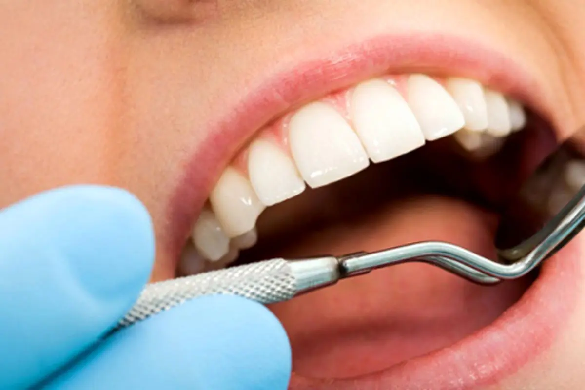 مضرترین مواد غذایی برای دندان‌ها چیست؟