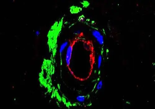 کشف شوکه کننده دانشمندان درباره  جهش ژنتیکی نادر را در انسان باستان +عکس
