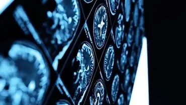 دستیابی دانشمندان به روشی برای کاهش مرگ و میر بیماران کرونایی