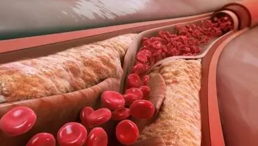 کلسترول و تری گلیسیرید چه تفاوتی با یکدیگر دارند؟