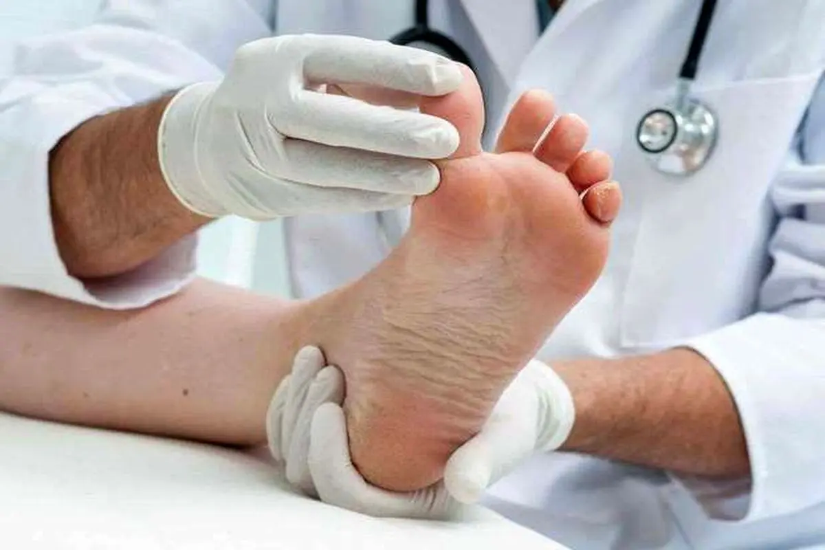 راهکار‌هایی ساده برای درمان ۵ بیماری شایع پا