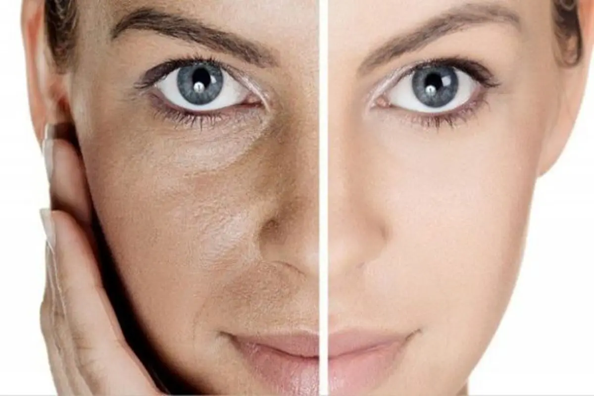 روش های ساده و طبیعی برای داشتن پوستی صاف و زیبا