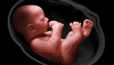 توضیحات یک متخصص زایمان در خصوص باید و نبایدهای غربالگری ژنتیکی