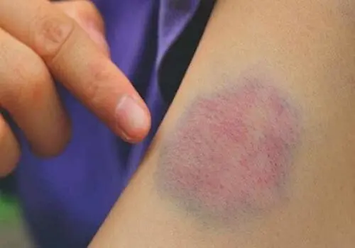 عواملی که با رعایت نکردن آنها رنگ پوستتان تیره می‌شود
