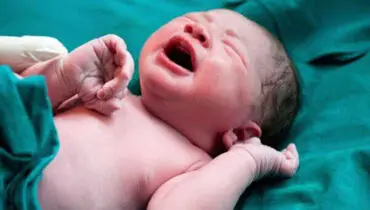 اذعان وزارت بهداشت به وجود اشکالات در غربالگری‌‌های مادران بارداری