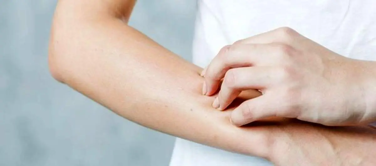 دلایل خشکی و خارش دستها +اینفوگرافیک