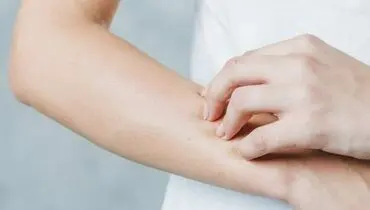 دلایل خشکی و خارش دست‌ها +اینفوگرافیک