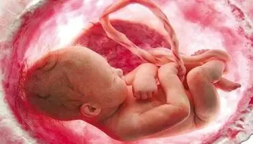 غربالگری بارداری از کدام اختلالات پیشگیری می‌کند؟