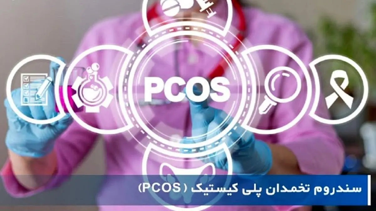 علائم و تشخیص سندرم تخمدان پلی کیستیک