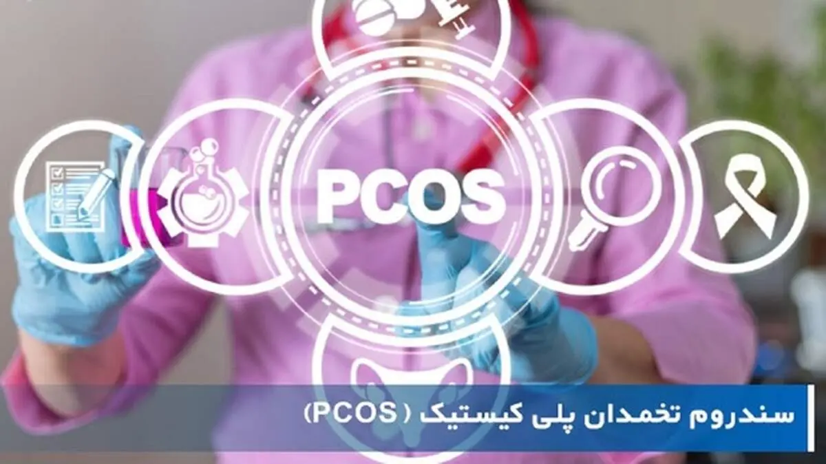 علائم و تشخیص سندرم تخمدان پلی کیستیک