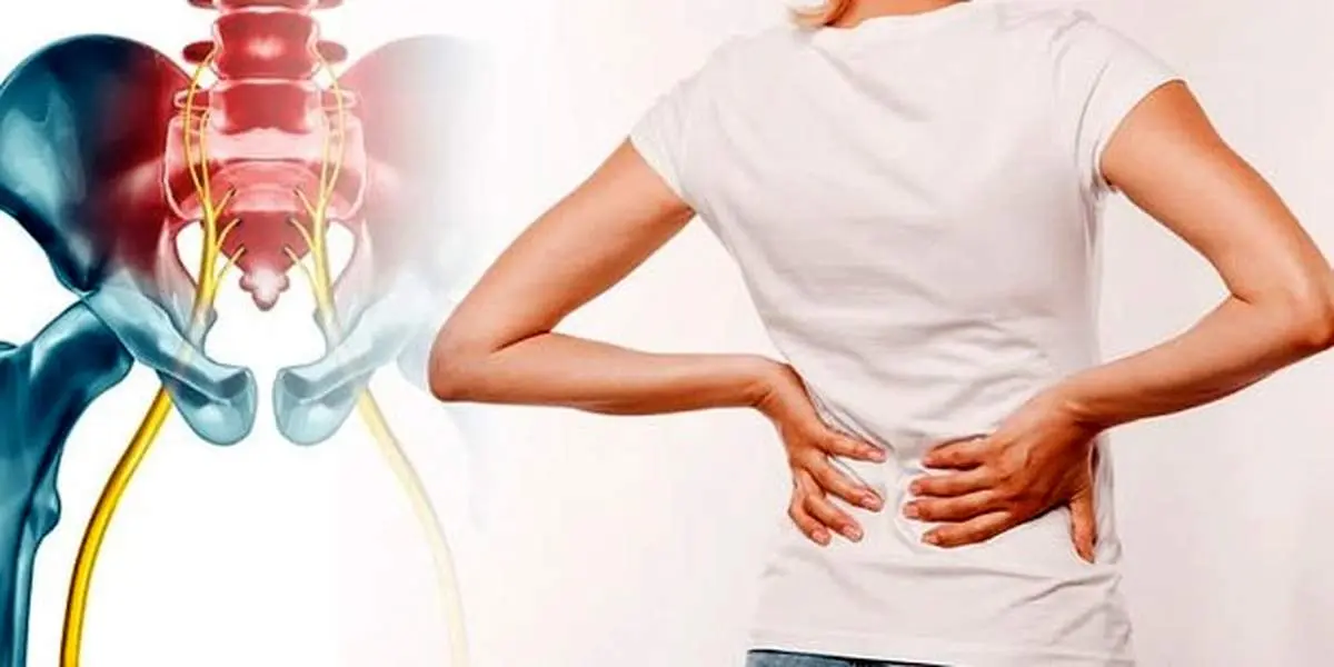 استرس چطور مانند سم برای سیاتیک عمل می‌کند؟