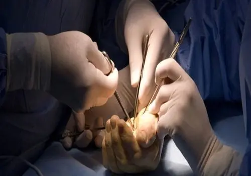 پس از ۵۰ سالگی این‌گونه از مفصل‌ها مراقبت کنید
