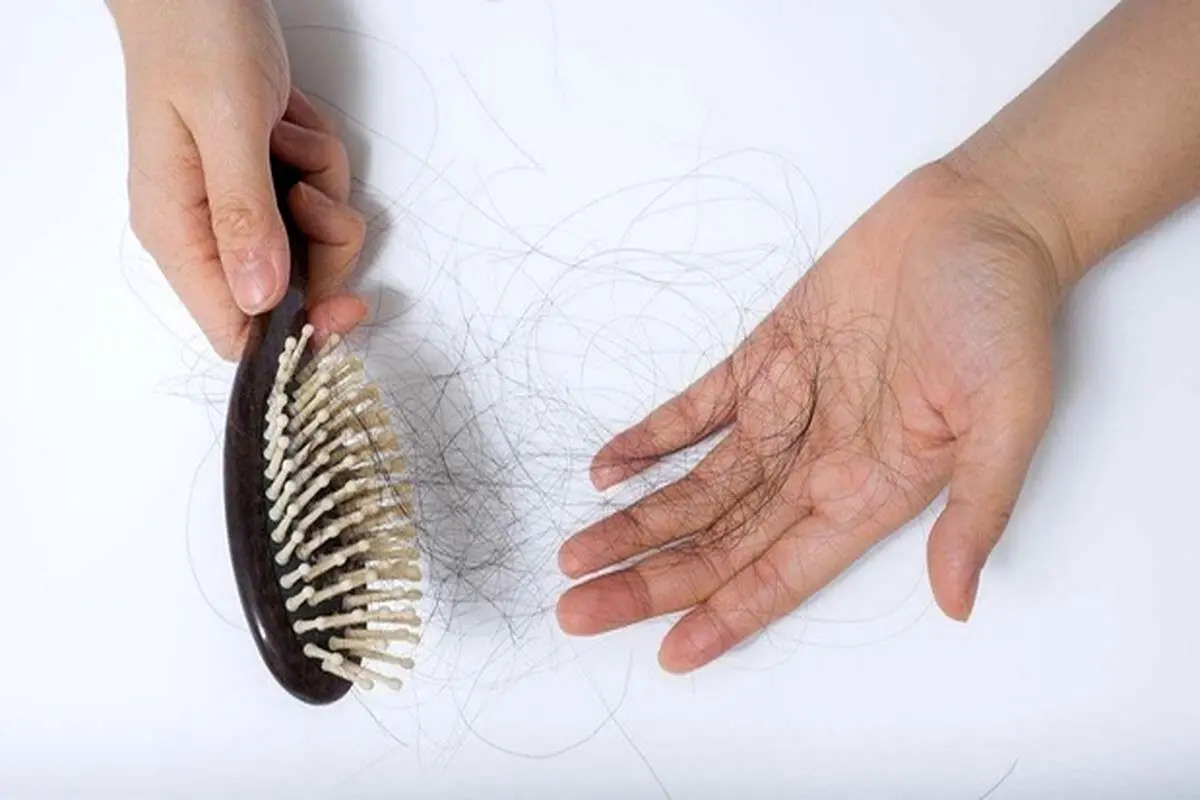 دلایل پزشکی درباره ریزش دائمی مو‌ها