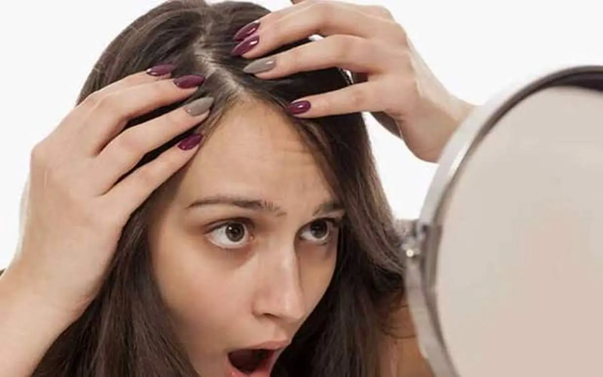 راهکارهای طب سنتی برای جلوگیری از ریزش مو
