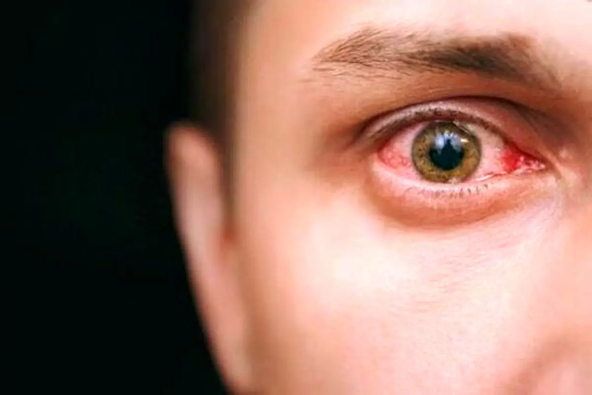 عوارض تداوم نگاه به صفحه موبایل+عکس