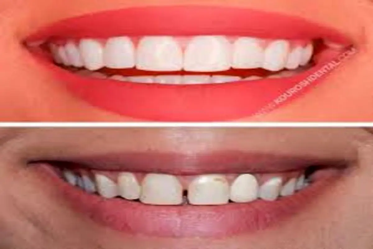 ۷ اشتباه بزرگی که هنگام مراقبت از دندان‌ها مرتکب می‌شویم+عکس