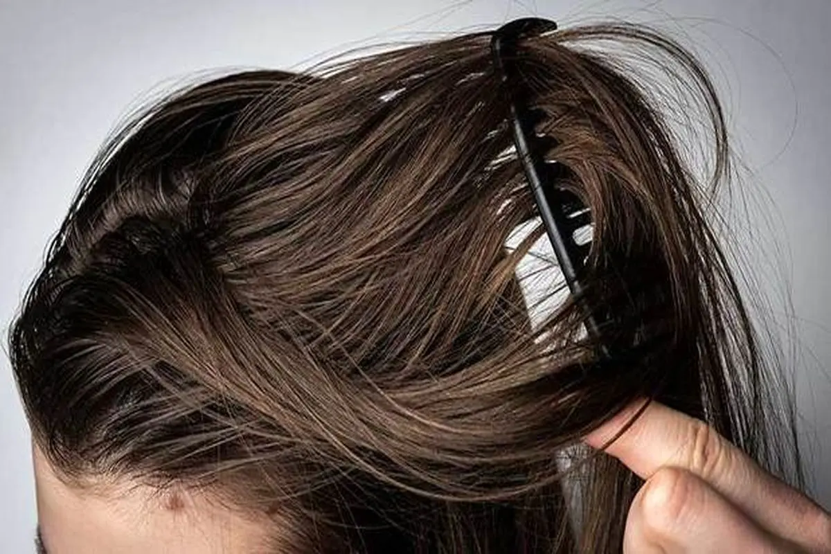 روش های درمانی برای کاهش چربی موی سر