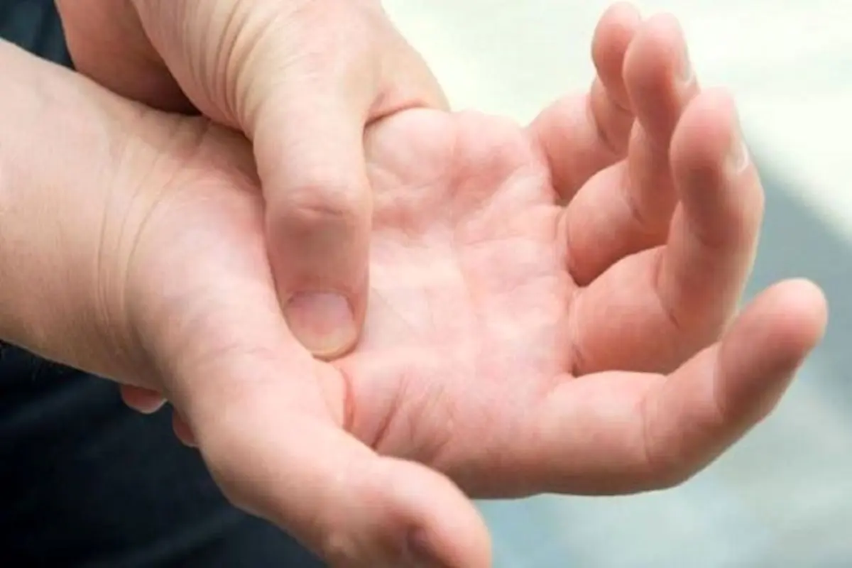 بیماری‌هایی که منجر به ورم انگشتان می‌شوند